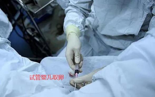 浙江杭州试管婴儿费用需要等多久才能被纳入医保进行报销